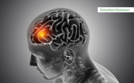 PERAWATAN YANG BAIK UNTUK ORANG STROKE