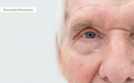 BENARKAH PENYAKIT KATARAK DAPAT MENURUN KEPADA ANAK?