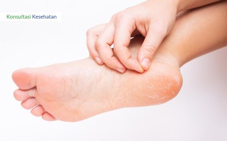 MASALAH KULIT KERING DAN GATAL DI KAKI